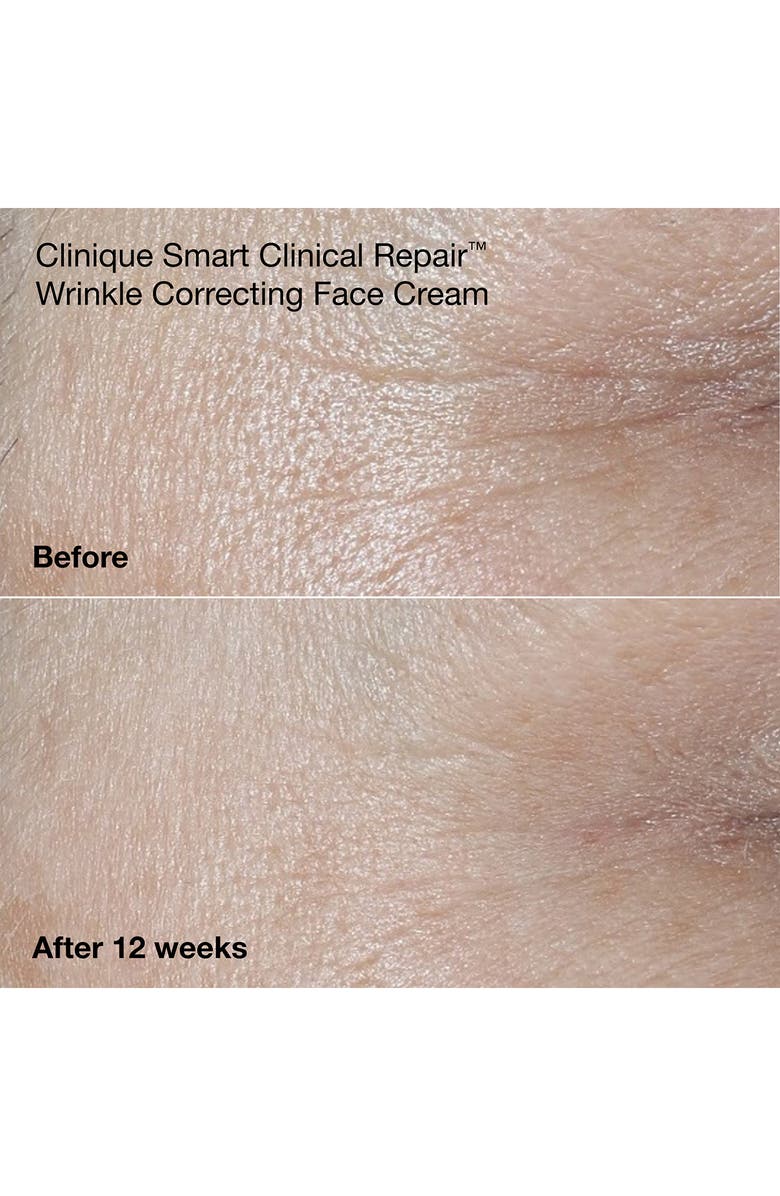 Clinique A+ De-Agers Anti-Aging Skin Care Set (Limited Edition) $173 Value, Alternate, color, 