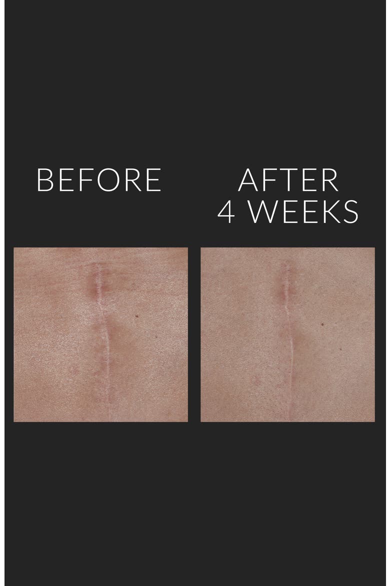 'D-Scar' Scar Diminishing Serum, Alternate, color, NO COLOR
