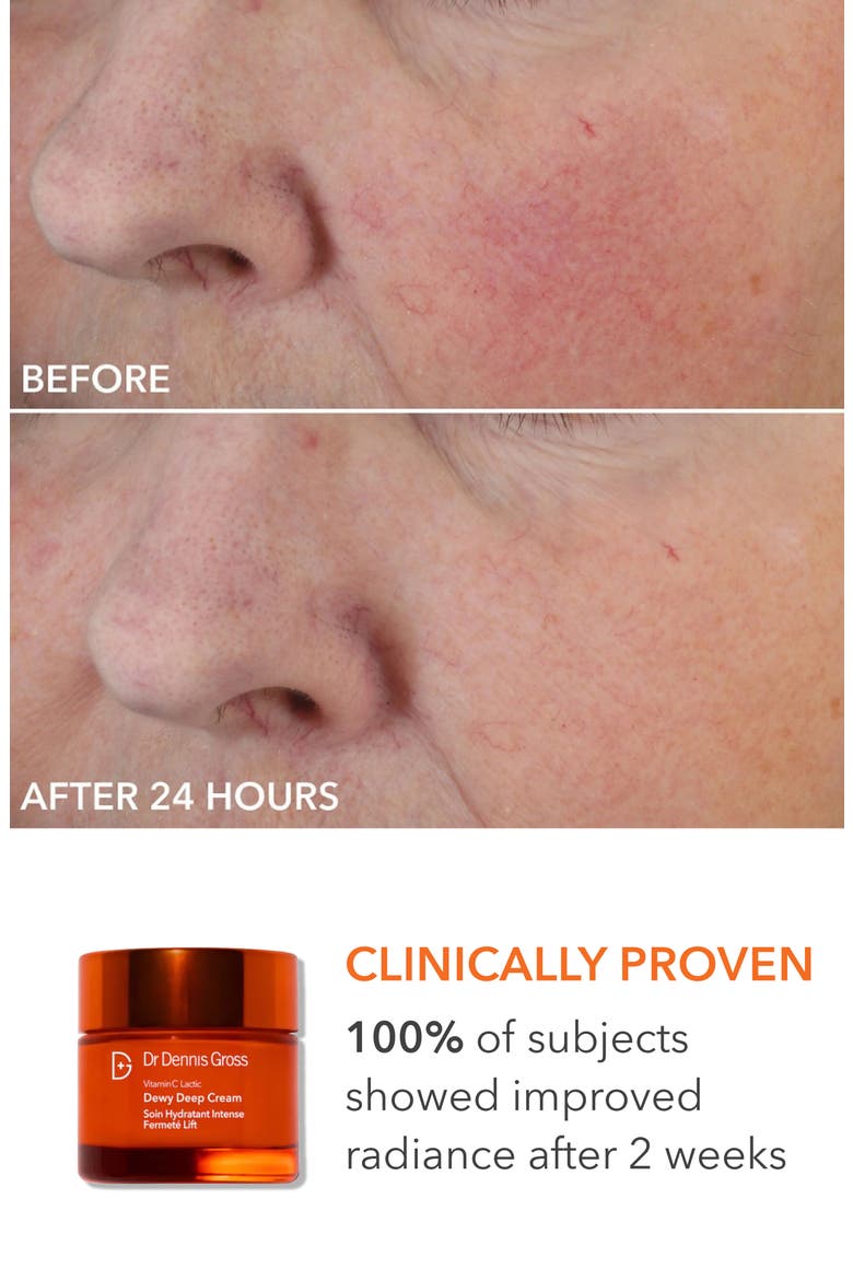 Collagen Boosting Essentials Set $641 Value, Alternate, color, NO COLOR