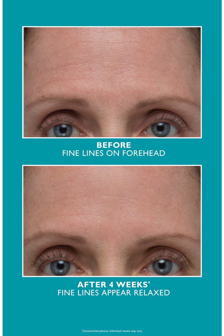 Peptide Skinjection Amplified Wrinkle-Fix Refillable Serum, Alternate, color, NO COLOR