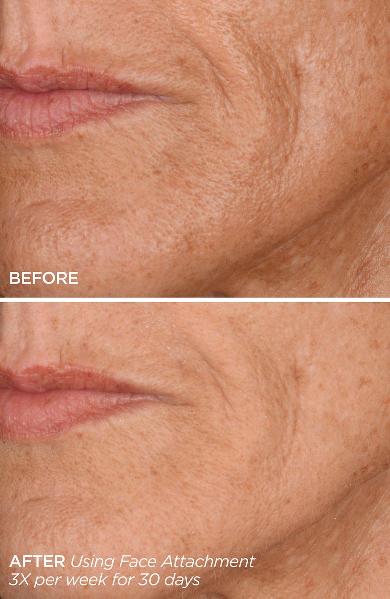 BeautyBio GloPRO<sup>®</sup> FACE MicroTip<sup>™</sup> Attachment Replacement Head, Alternate, color, Ivory