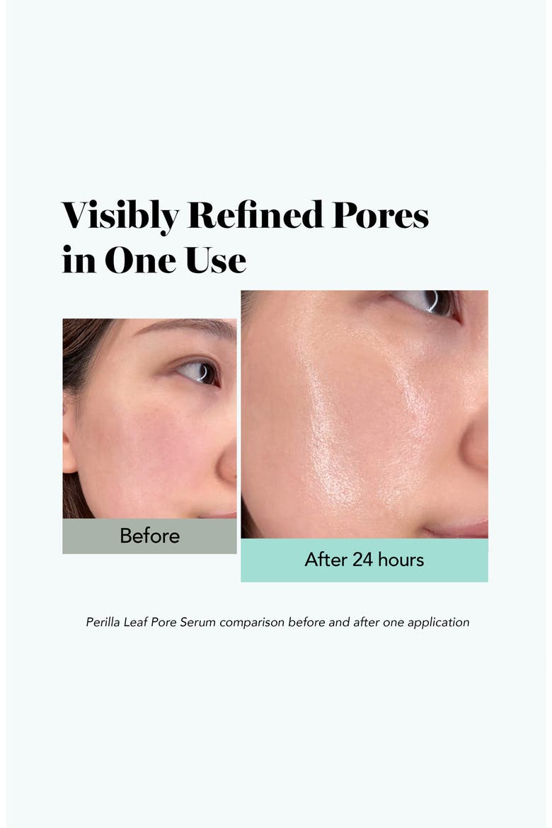 Perilla Leaf Pore Serum, Alternate, color, NO COLOR