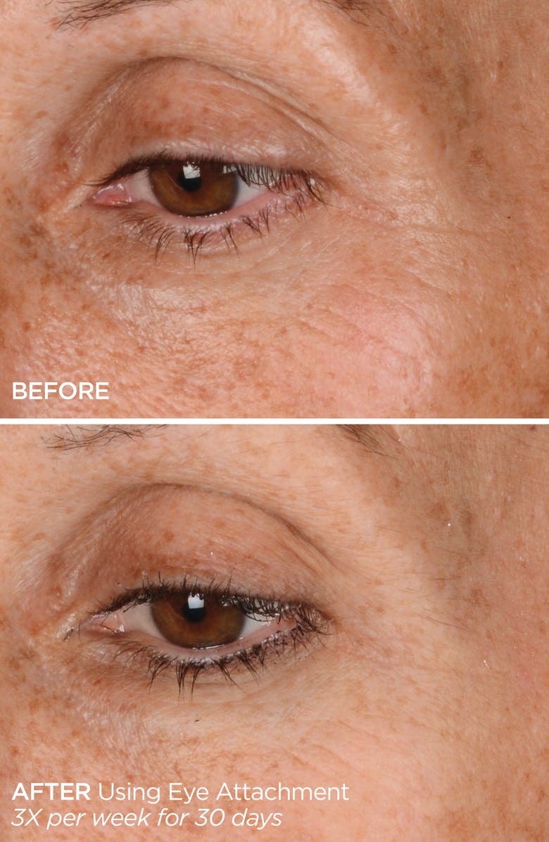 BeautyBio GloPRO<sup>®</sup> EYE MicroTip<sup>™</sup> Attachment Replacement Head, Alternate, color, White