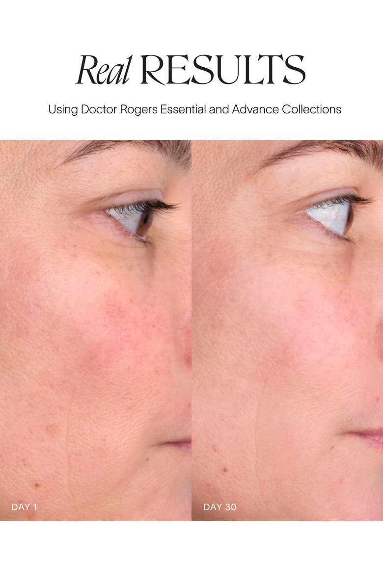 DOCTOR ROGERS Day Preventive Treatment, Alternate, color,