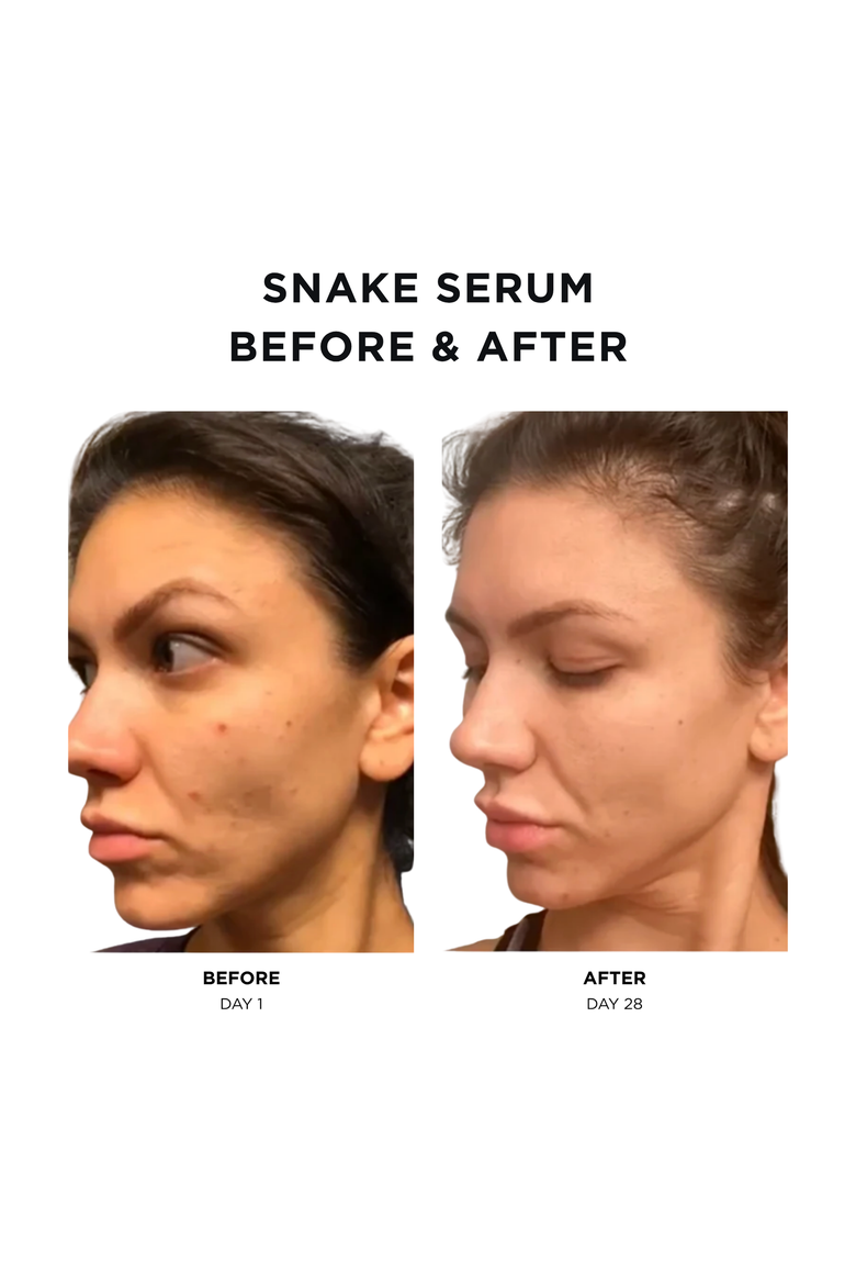 Snake Serum | 1 fl oz/ 30 ml | Anti-Aging Formula with Vegan Snake Peptides | Hydrating Hyaluronic Acid | Niacinamide for Radiant Skin Repair, Alternate, color, None
