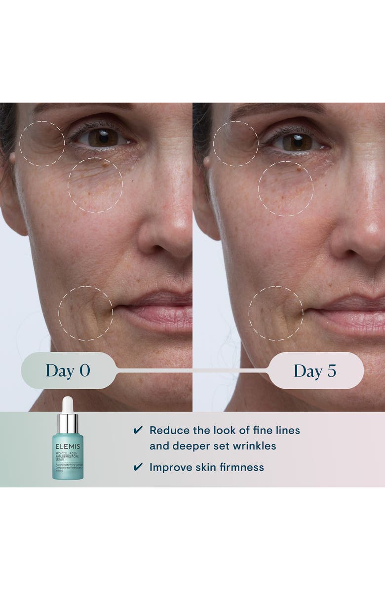 Elemis Pro-Collagen Future Restore Serum, Alternate, color,