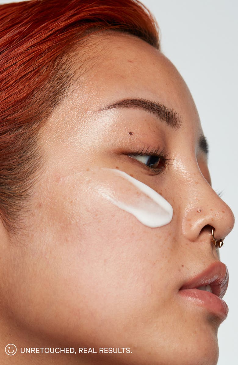 Kate Somerville<sup>®</sup> Breakout Busters Set (Limited Edition) $102 Value, Alternate, color,