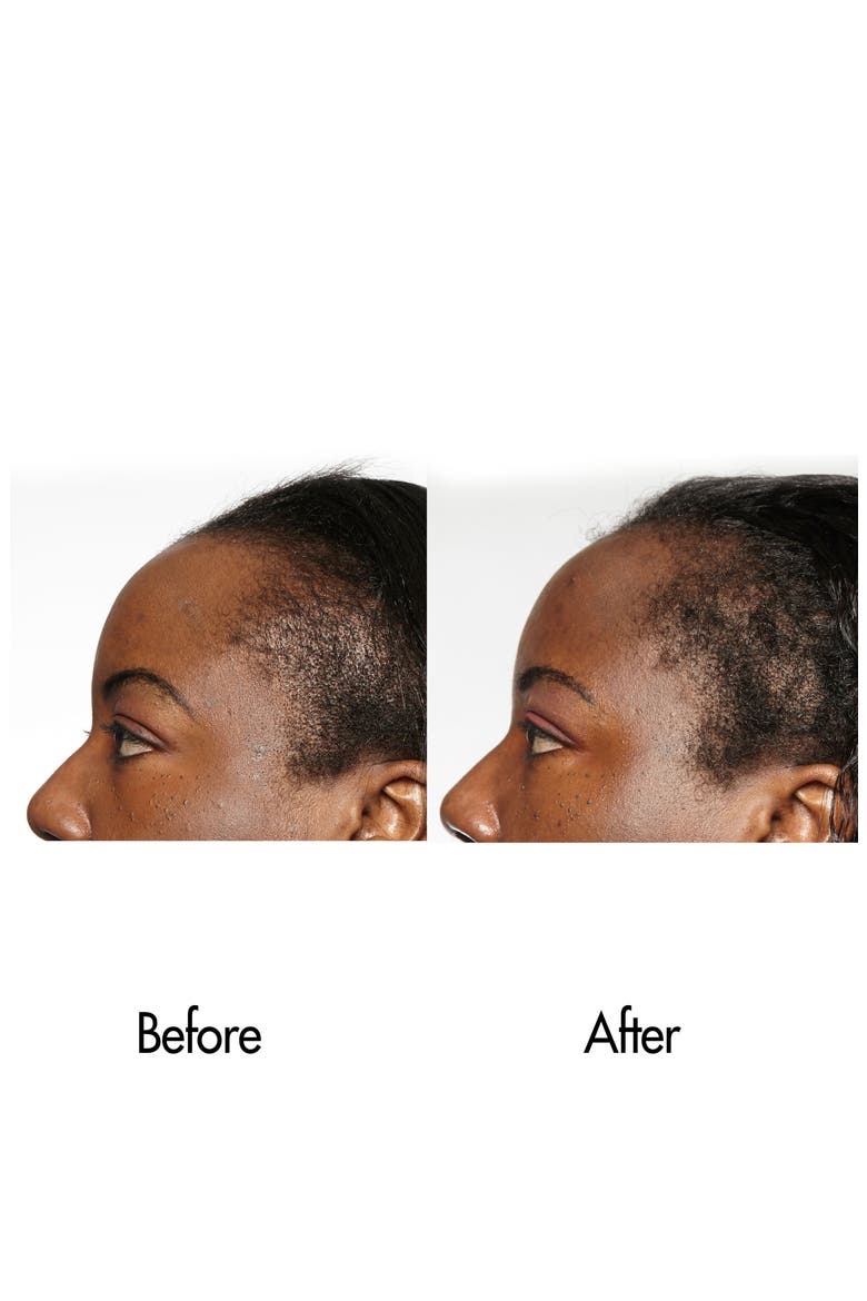 Follicle Boosting Serum, Alternate, color, NO COLOR