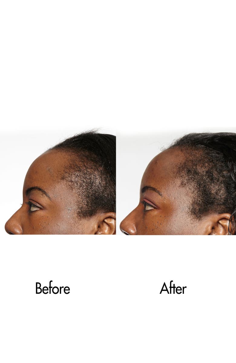 Keranique Follicle Boosting Serum, Alternate, color,