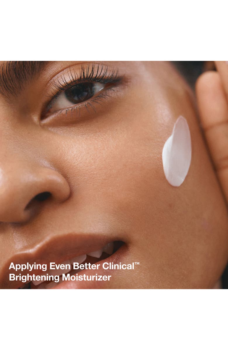 Clinique Even Tone Experts Brightening Skin Care Set (Limited Edition) $92 Value, Alternate, color, 