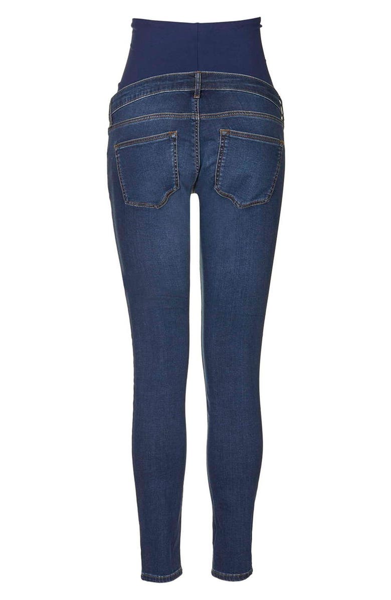 Topshop 'Leigh' Skinny Maternity Jeans, Alternate, color,