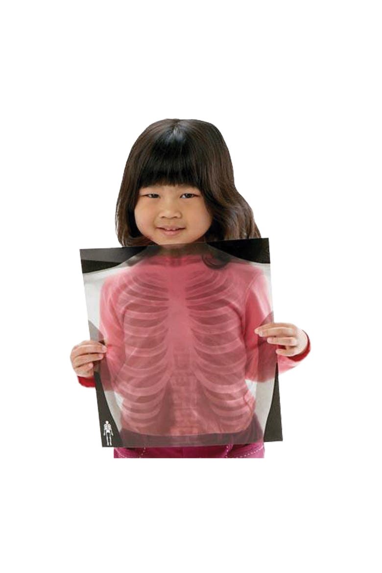 Human X-Rays on Film, Alternate, color, Multicolor