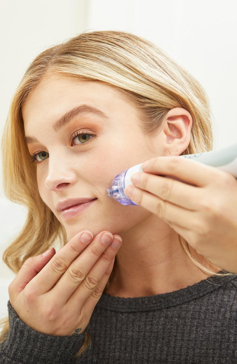 PMD Classic Personal Microderm Device, Alternate, color,