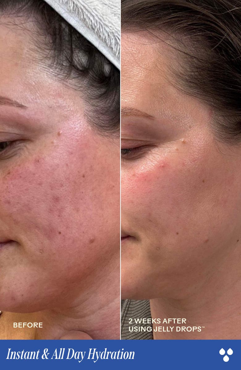 Three Ships Jelly Drops<sup>™</sup> Hyaluronic Acid Serum, Alternate, color, 