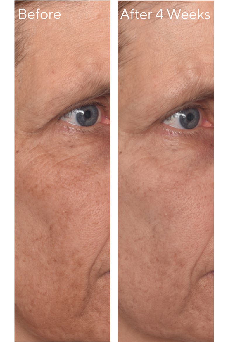 Vita-C Glycolic Serum, Alternate, color, NO COLOR