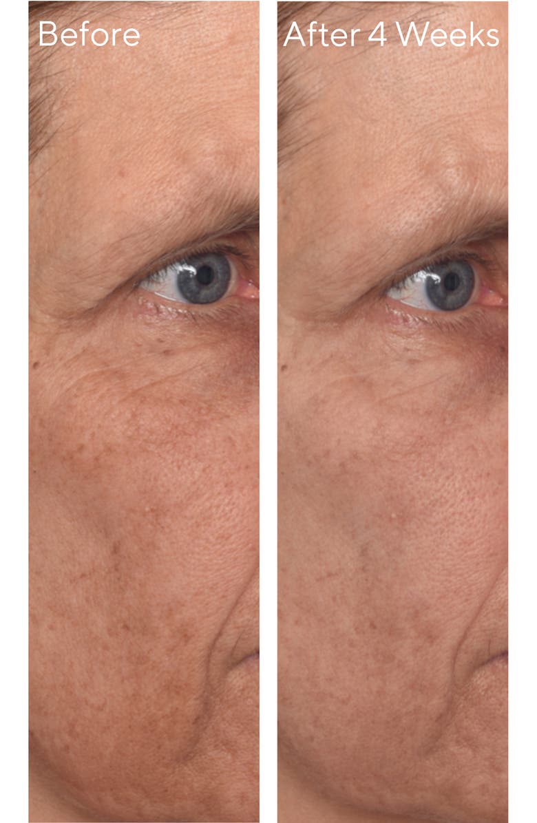 Murad<sup>®</sup> Vita-C Glycolic Serum, Alternate, color,