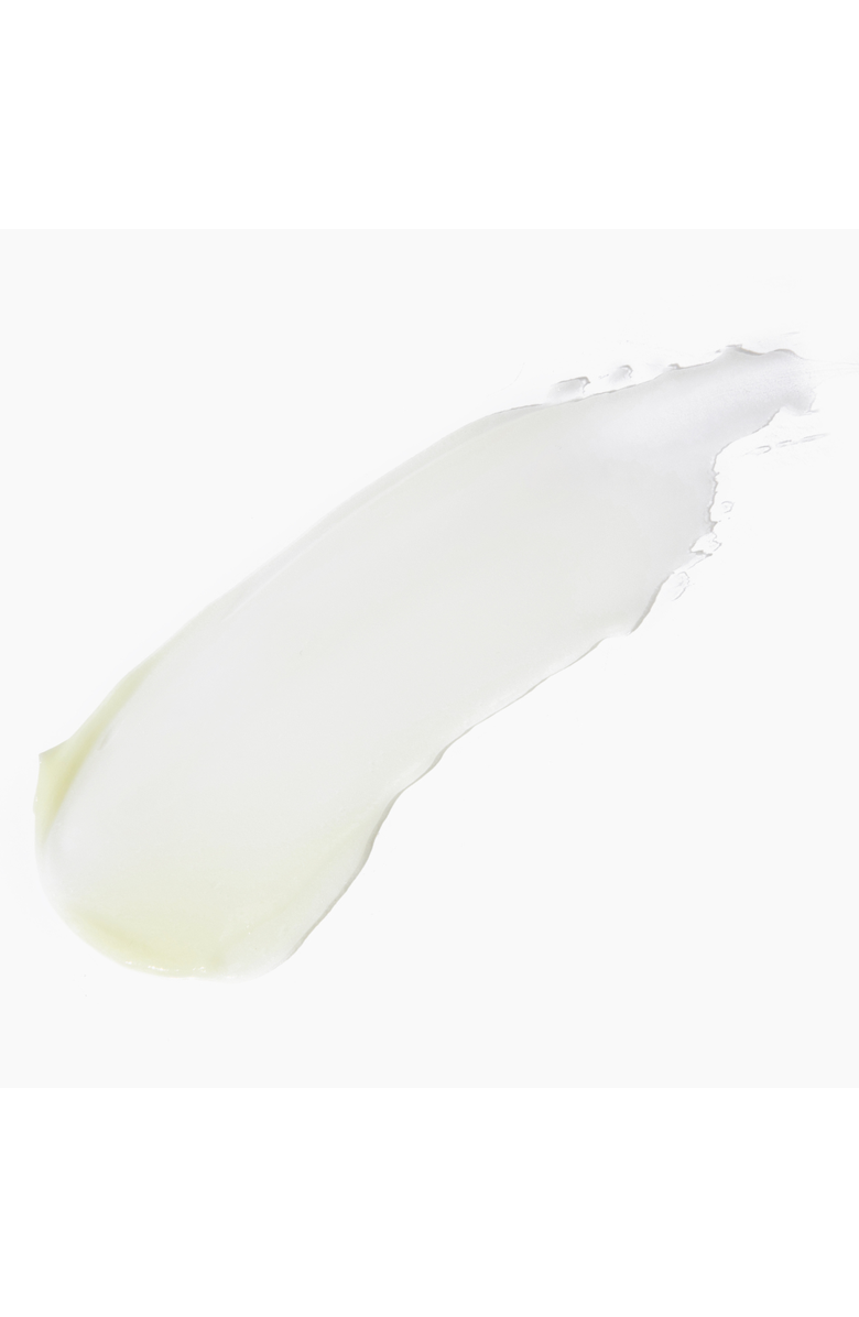 TONES by Cocoa Acne Treatment Cream with Benzoyl Peroxide 29.5ml, Alternate, color, 