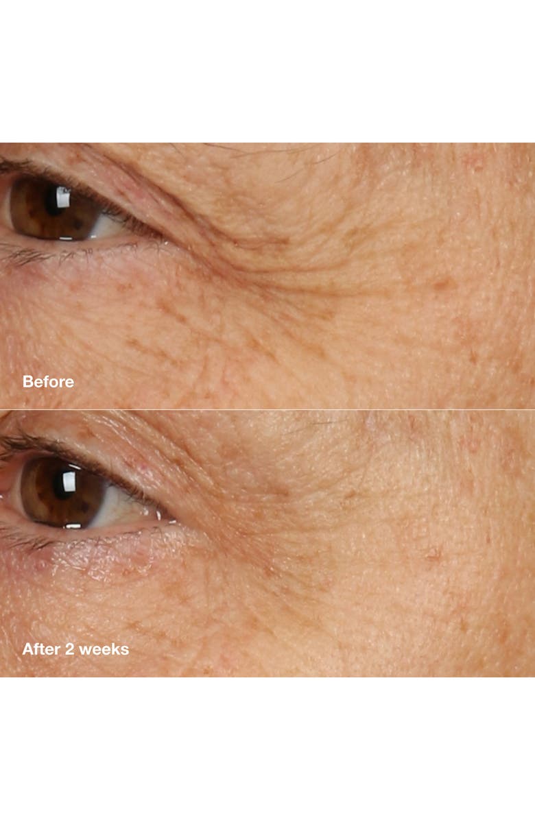 Clinique Smart Clinical Repair<sup>™</sup> Overnight Recovery Face Cream + Mask, Alternate, color,