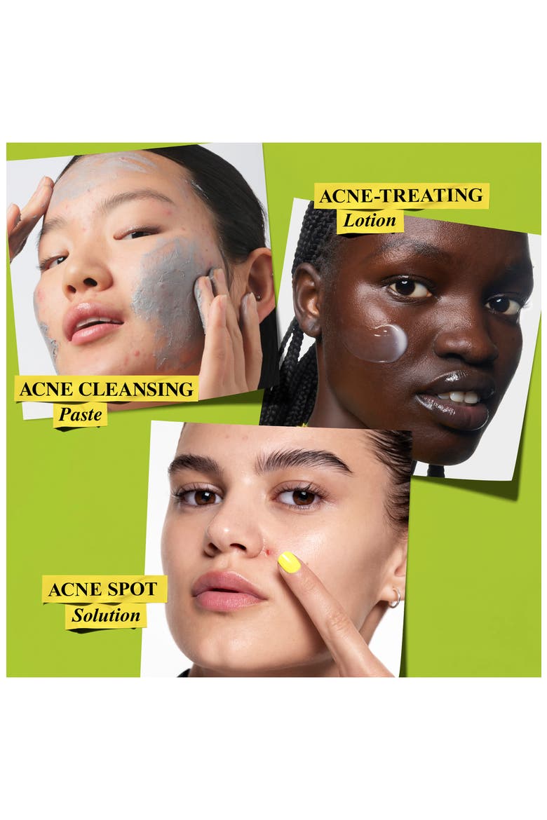 Clear Intentions Skin Care Set for Acne $98 Value, Alternate, color, NO COLOR
