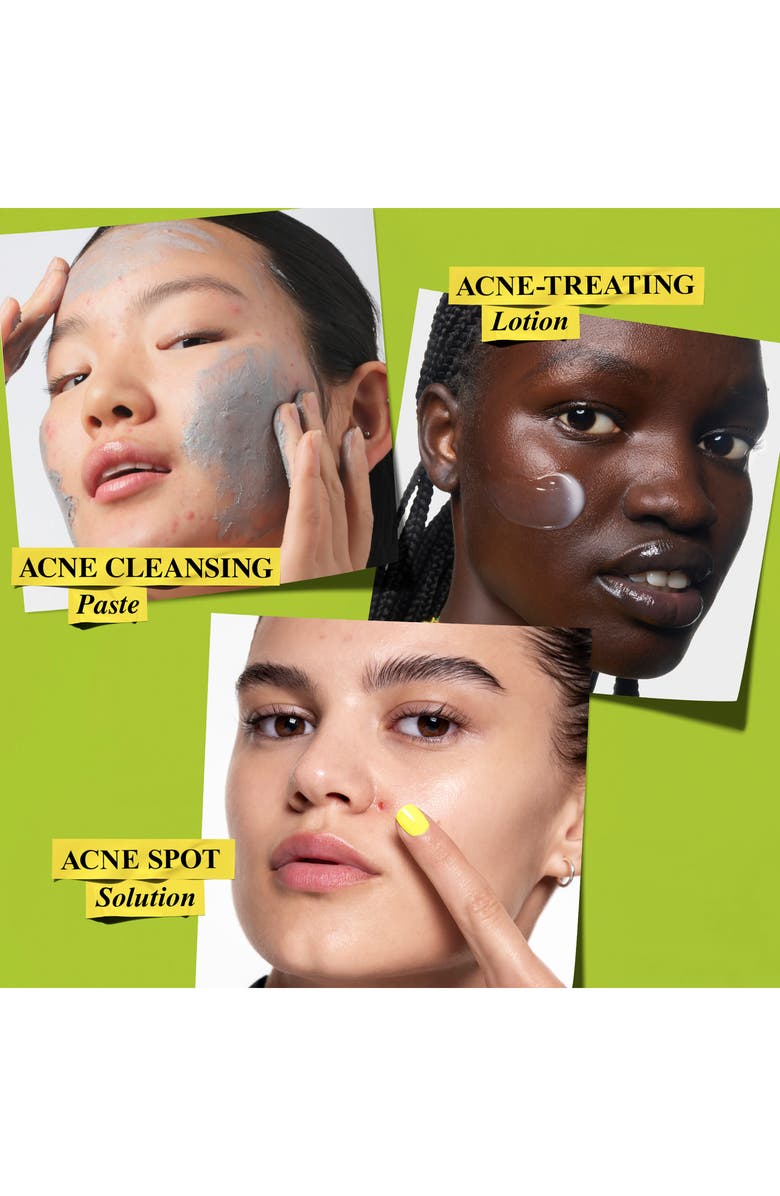 Kiehl's Since 1851 Clear Intentions Skin Care Set for Acne $98 Value, Alternate, color, 