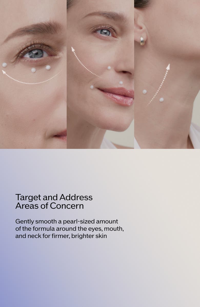 Shiseido Vital Perfection Intensive WrinkleSpot Treatment A+, Alternate, color, 