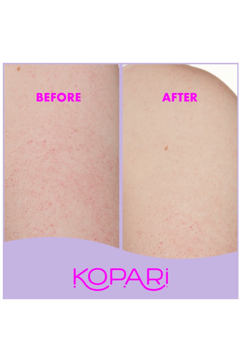 KP Body Bumps Be Gone with 10% AHA Exfoliator, Alternate, color, NO COLOR