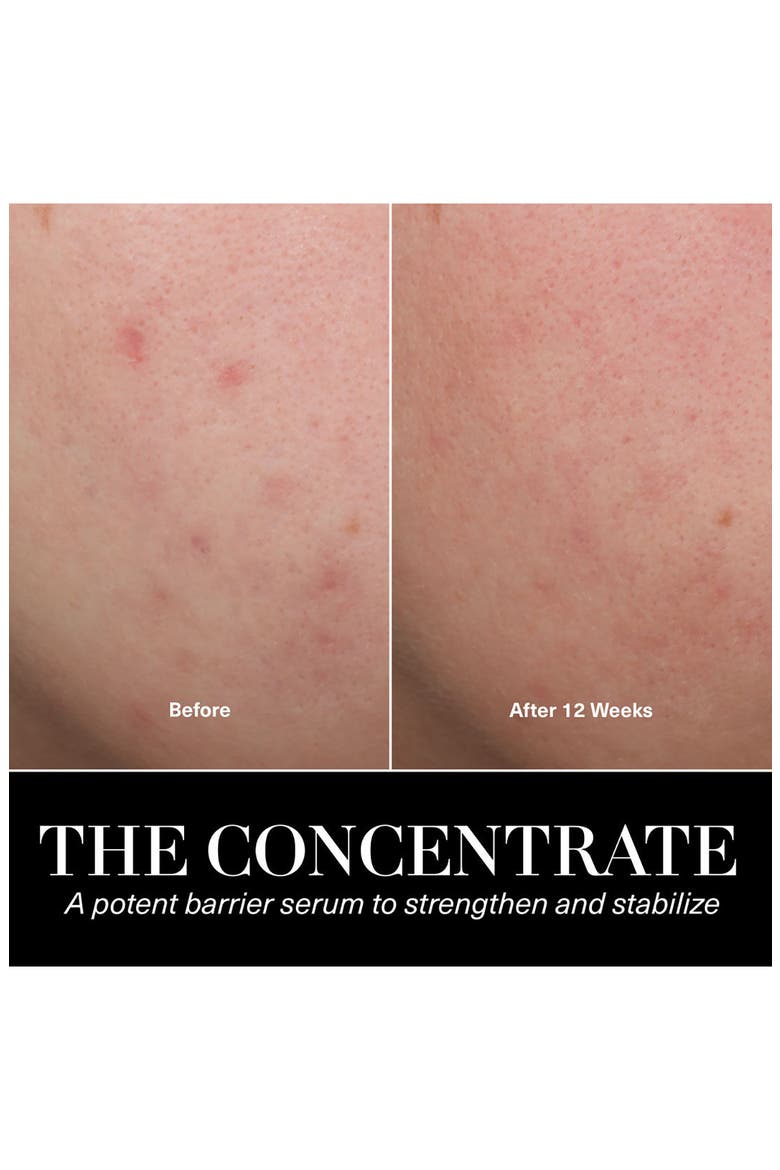 The Concentrate Serum for Barrier Repair & Hydration, Alternate, color, NO COLOR