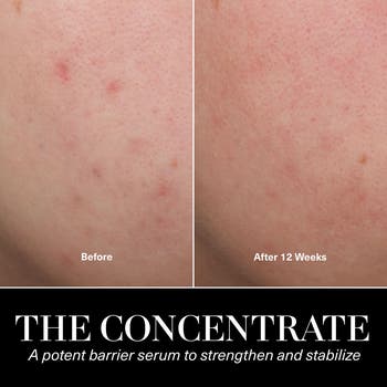 The Concentrate Serum Duo $665 Value