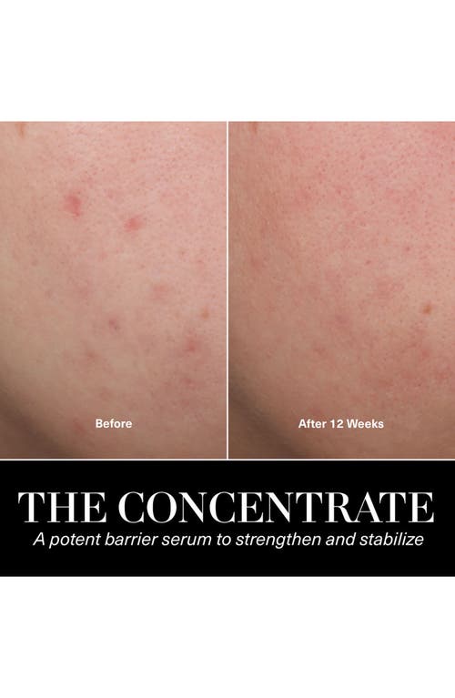 La Mer Large The Concentrate Serum $1,200 Value In Transparent