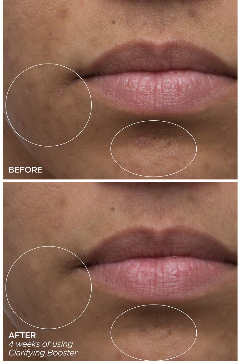 Clarifying Salicylic Acid Booster Serum, Alternate, color, NO COLOR