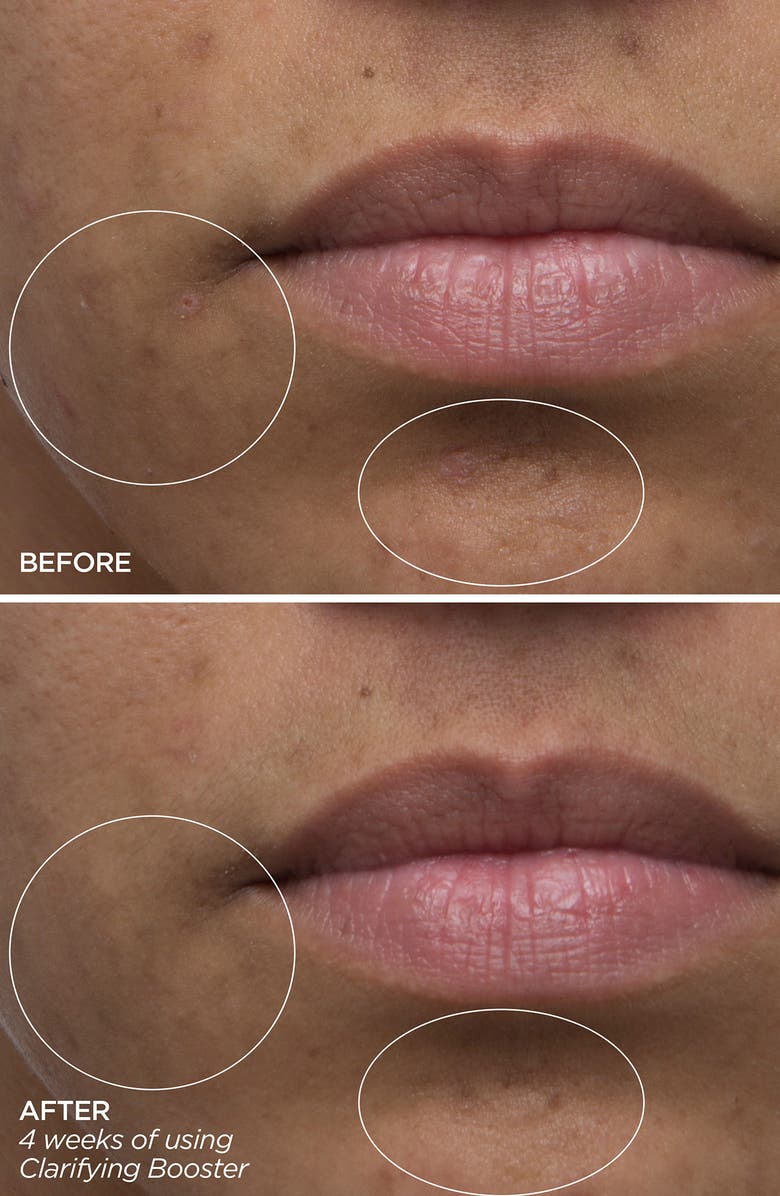 BeautyBio Clarifying Salicylic Acid Booster Serum, Alternate, color, 