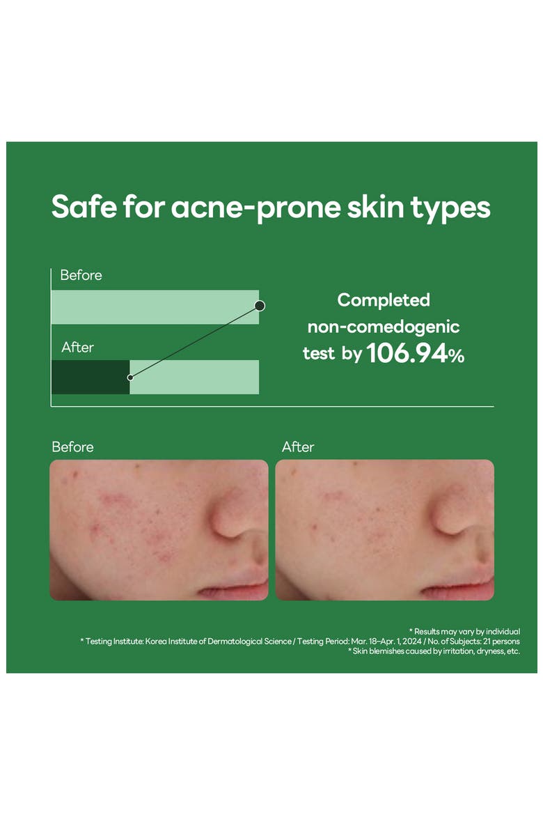 Teatree Calming Hydra Serum, Alternate, color, DARK GREEN
