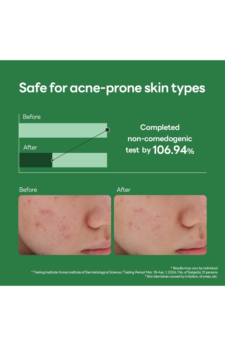 MEDIHEAL Teatree Calming Hydra Serum, Alternate, color, Dark Green