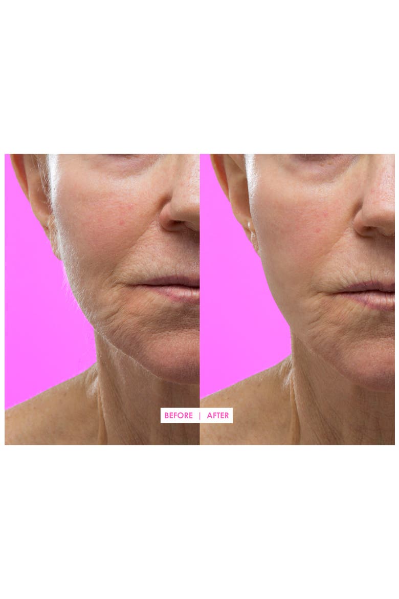 Hot Pink Facial Exfoliating Device, Alternate, color, NO COLOR