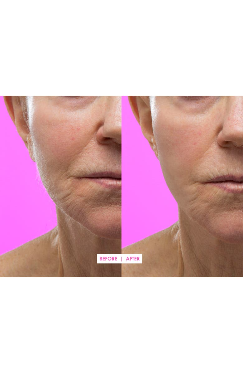 DERMAFLASH Hot Pink Facial Exfoliating Device, Alternate, color, 