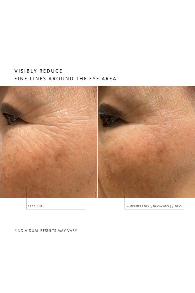 Facial Treatment System Pro Device, Alternate, color, None