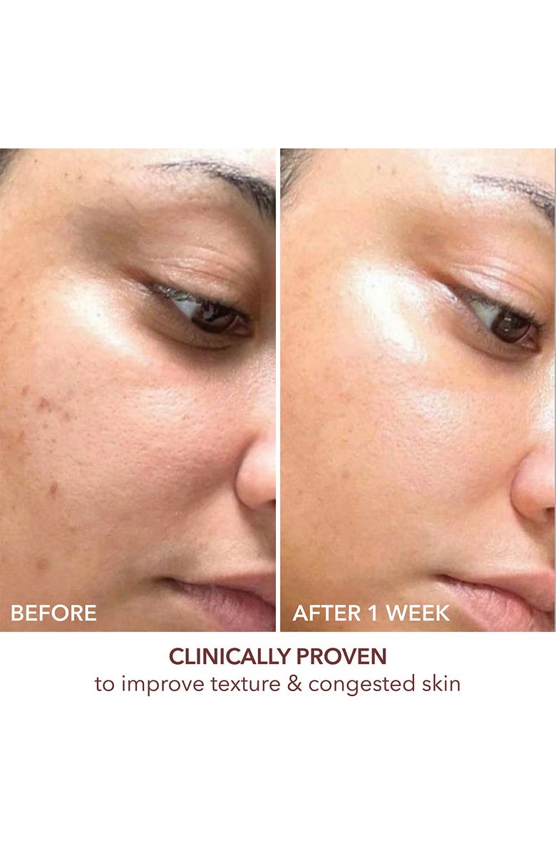 Dr. Dennis Gross Skincare Advanced Retinol + Ferulic Texture Renwal Serum, Alternate, color, 