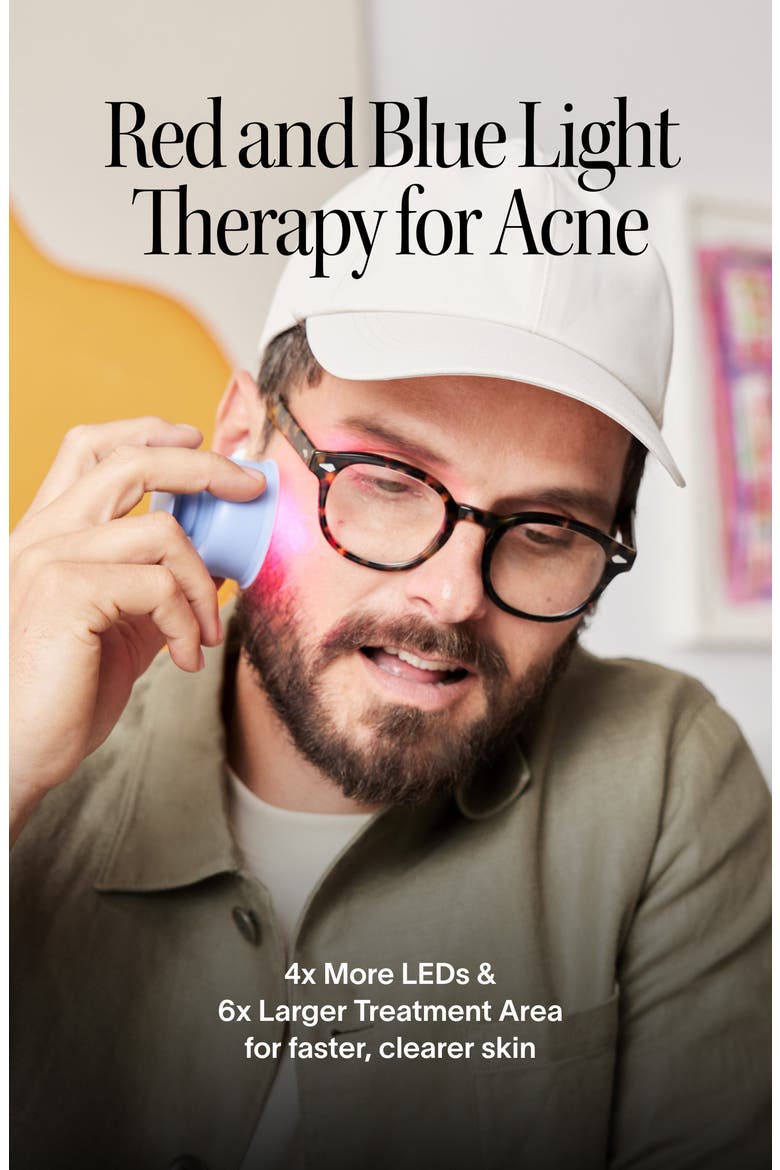 Bye Acne 3-Minute Light Therapy Acne Spot Device, Alternate, color, NO COLOR