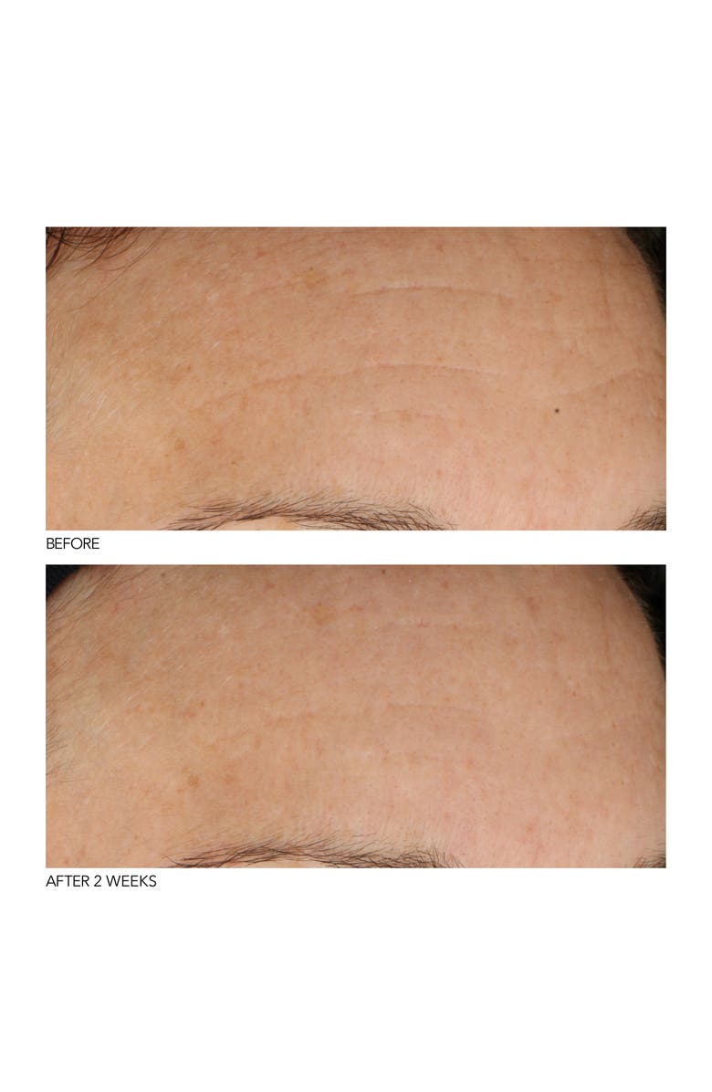 Dr. Dennis Gross Skincare B3Adaptive SuperFoods<sup>™</sup> Stress Repair Face Cream, Alternate, color, 