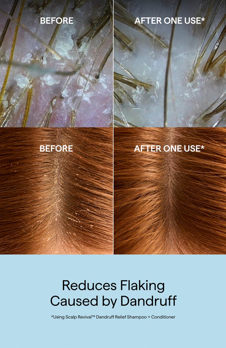 Briogeo Scalp Revival Dandruff Relief Shampoo, Alternate, color, 