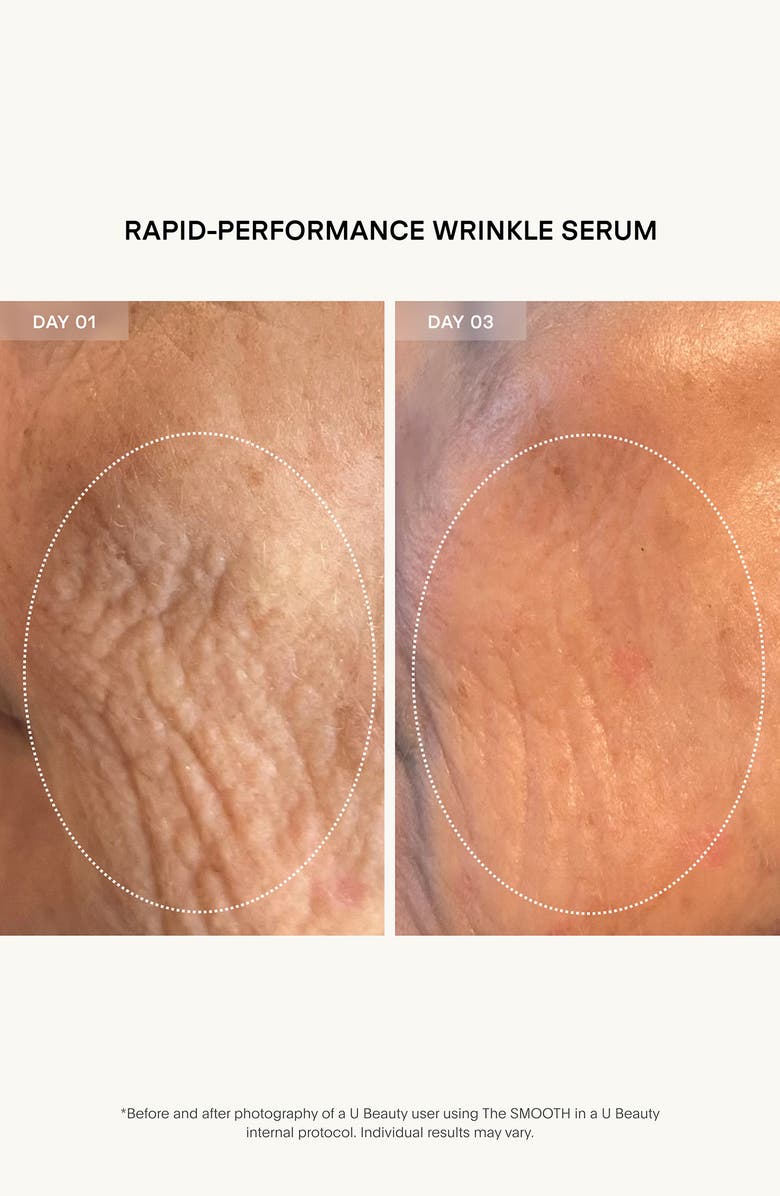 U Beauty The SMOOTH Dynamic Wrinkle Defense Serum, Alternate, color, 