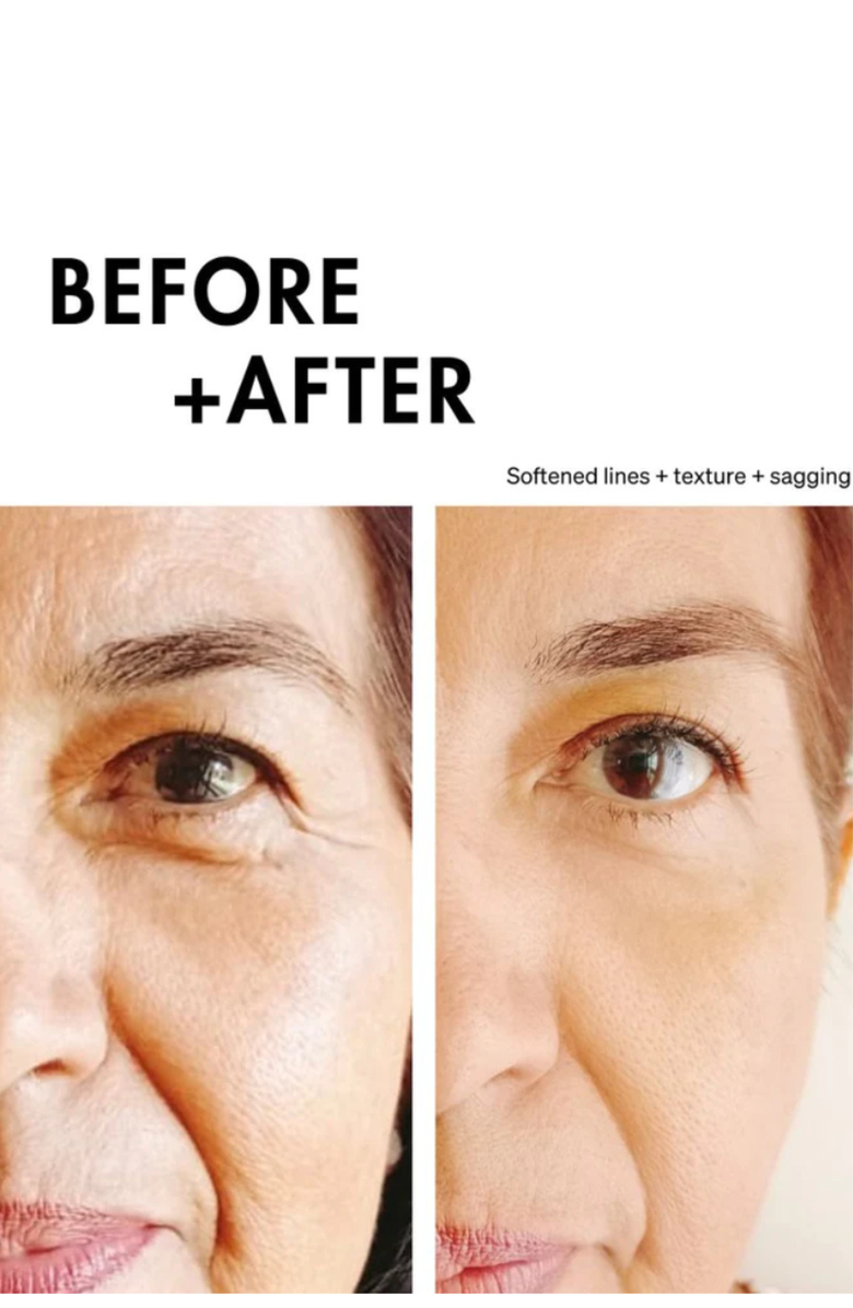 LUCE BEAUTY Face and Neck Microcurrent Wand - Pro, Alternate, color, Gold