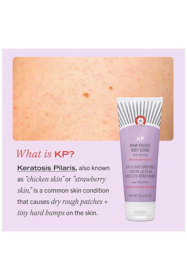 KP Bump Eraser Body Scrub Duo $60 Value, Alternate, color, NO COLOR