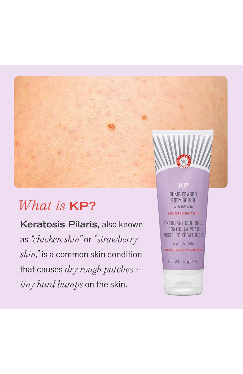 First Aid Beauty KP Bump Eraser Body Scrub Duo $60 Value, Alternate, color, 