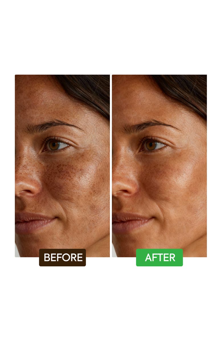 Makari de Suisse Kojic Acid Dark Spot Remover Soap Bars, Alternate, color, NO COLOR