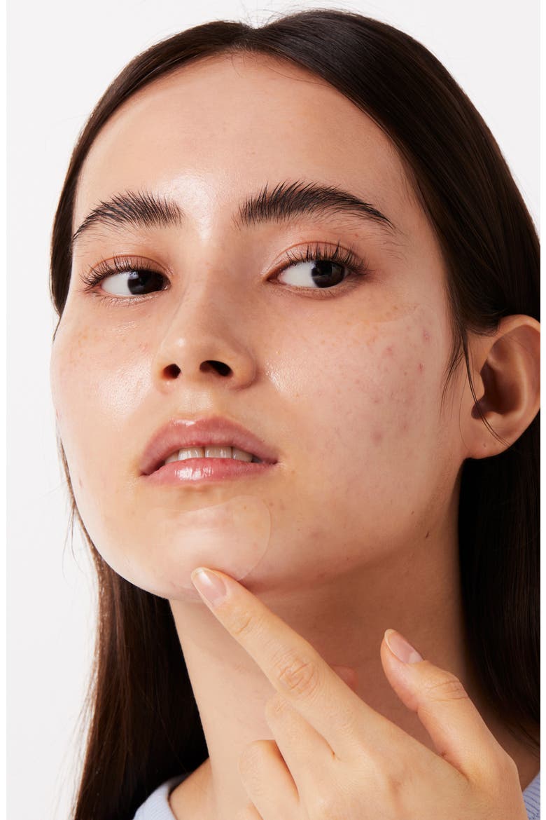 Timeout Blemish Patch Chin & Cheeks, Alternate, color, CLEAR