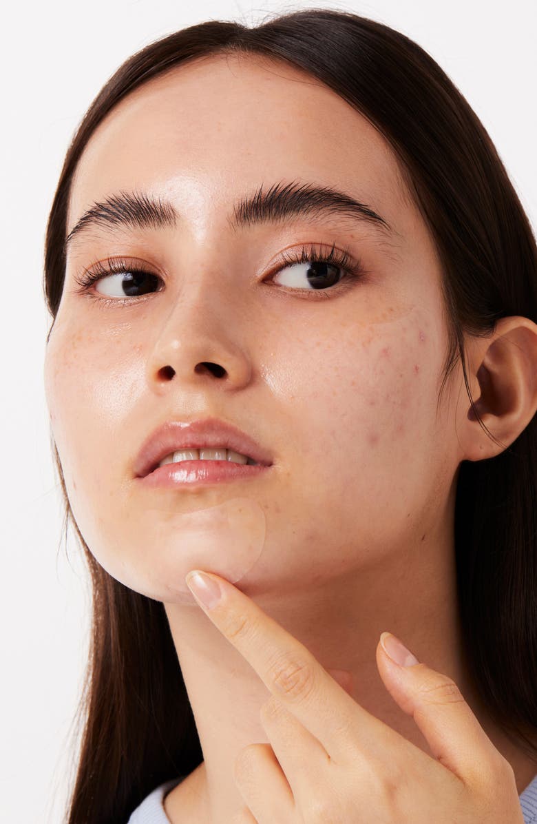 I DEW CARE Timeout Blemish Patch Chin & Cheeks, Alternate, color, Clear