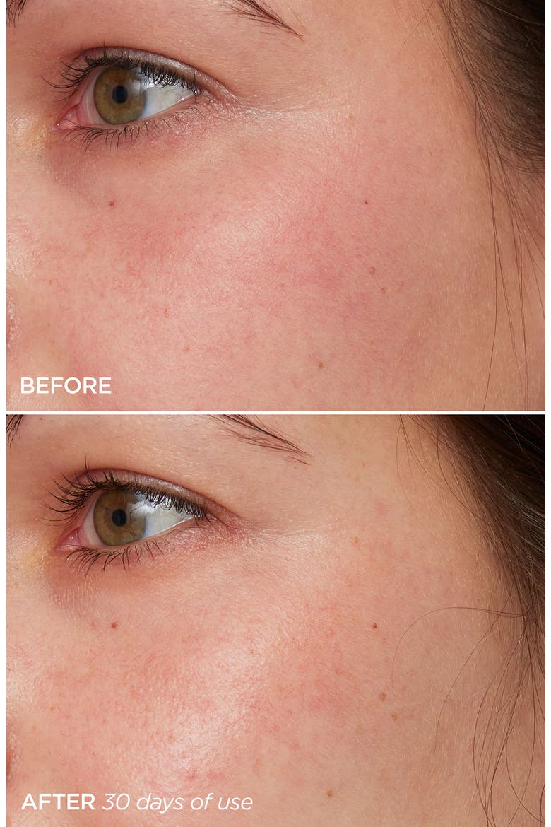 The Daily Acid-Free Vitamin C Brightening Serum, Alternate, color, NO COLOR