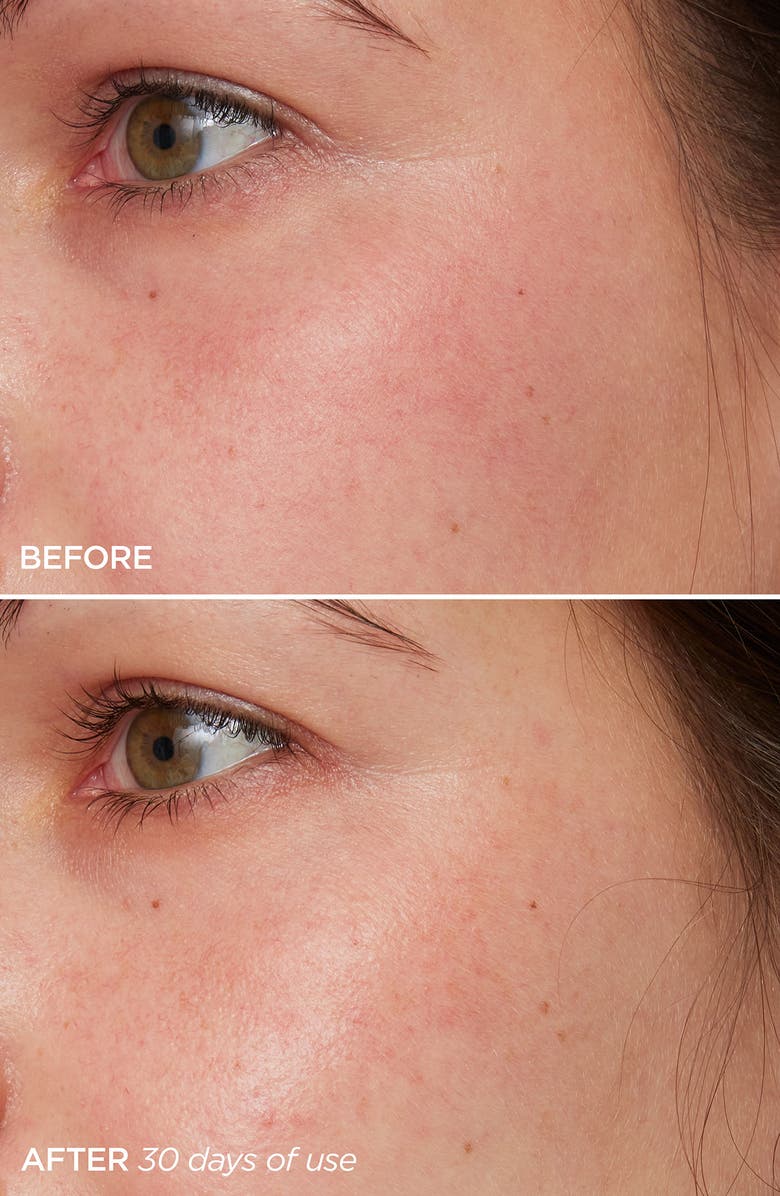 BeautyBio The Daily Acid-Free Vitamin C Brightening Serum, Alternate, color,