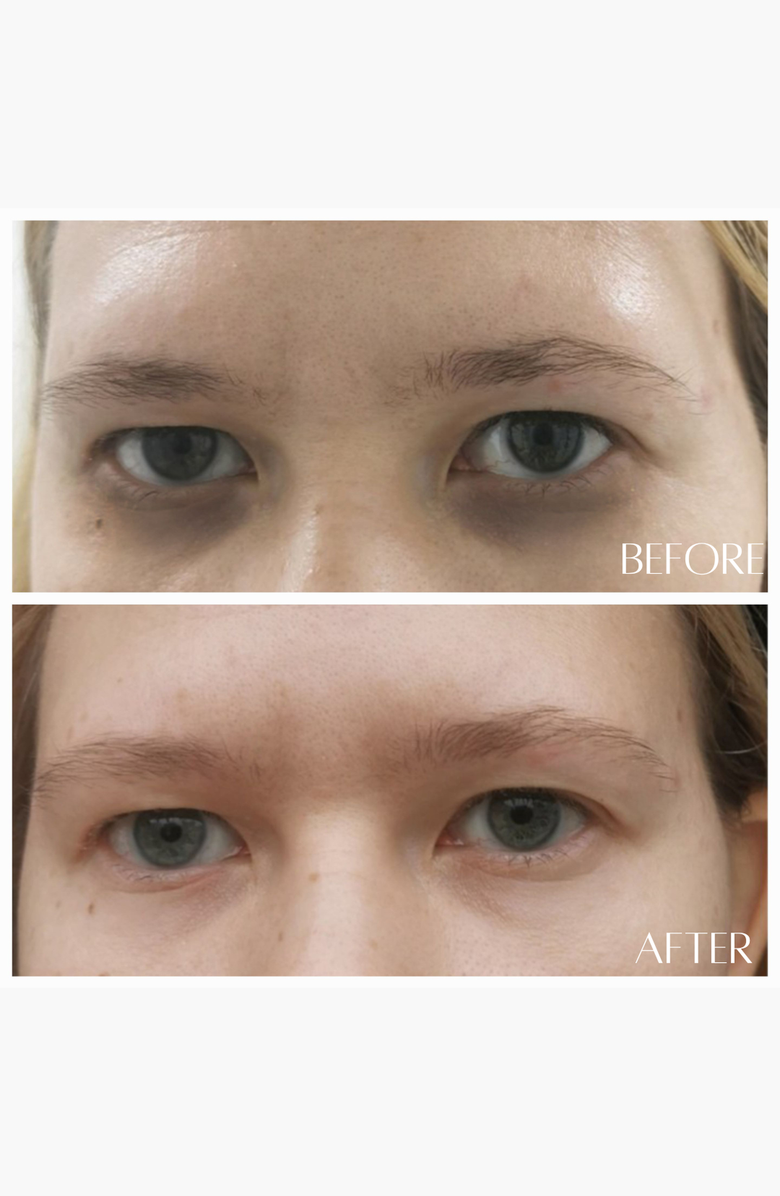 botanicary No. 8 REAWAKEN 24k Gold Illuminating Eye Elixir, Alternate, color, Gold